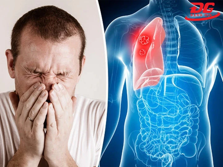 Bụi trong sản xuất ảnh hưởng đến sức khỏe