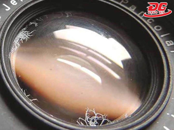 máy ảnh bị mốc