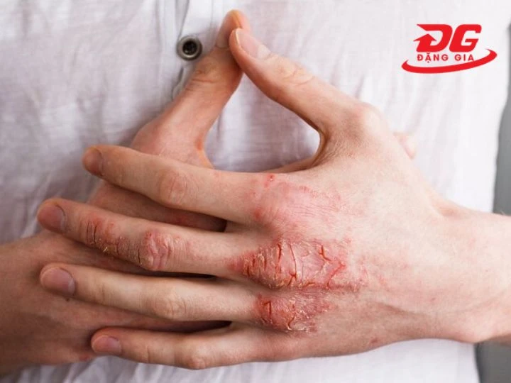 đe dọa tới sức khỏe con người