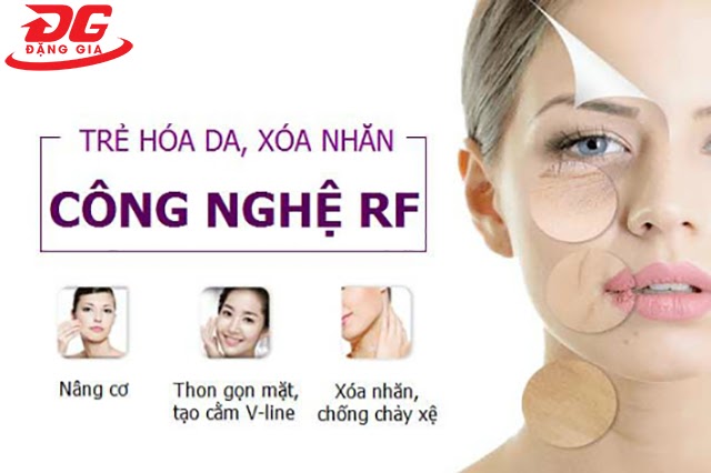 Dùng sóng RF có hại hay không ?